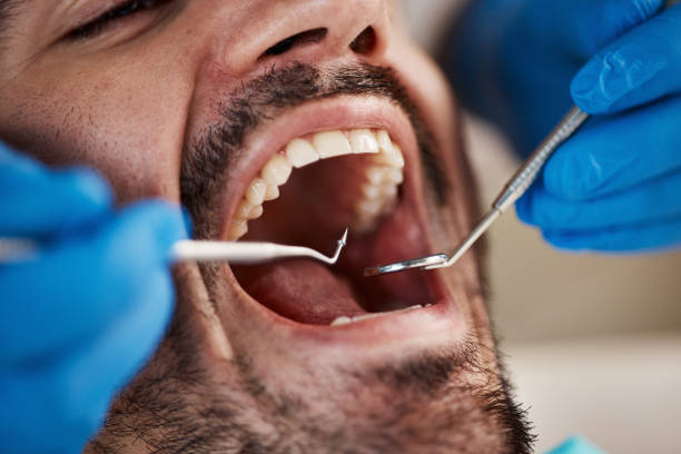 Best Emergency Broken Tooth Repair in Woodridge, IL