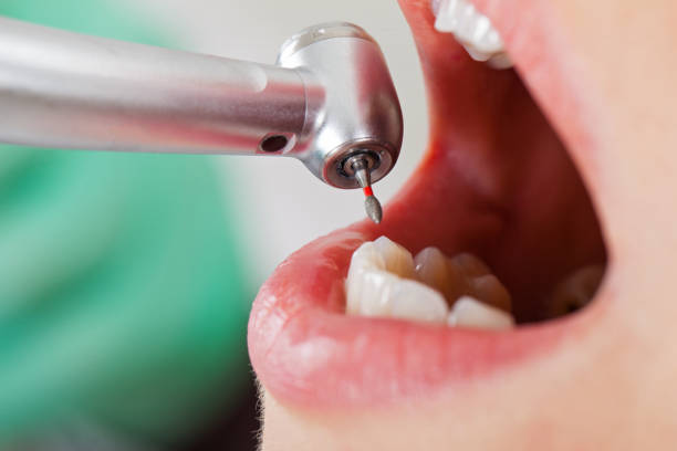 Best Emergency Treatment for Toothache in Woodridge, IL